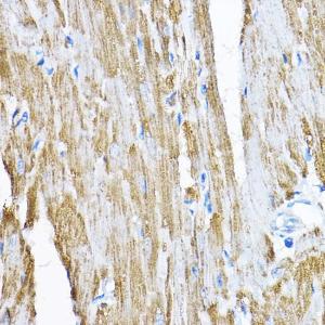 Immunohistochemistry analysis of paraffin-embedded rat heart using Anti-SAMM50/SAM50 Antibody (A11642) at a dilution of 1:200 (40x lens) Perform high pressure antigen retrieval with 10 mM citrate buffer pH 60 before commencing with IHC staining protocol