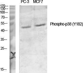 Anti-p38 MAPK alpha Rabbit Polyclonal Antibody