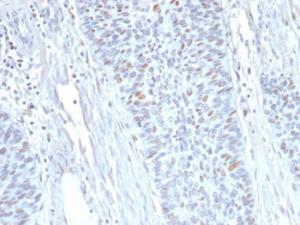 Immunohistochemical analysis of formalin-fixed, paraffin-embedded human endometrium using Anti-Cyclin A2 Antibody [E67]