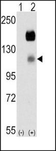 Anti-PTK7 Rabbit Polyclonal Antibody (AP (Alkaline Phosphatase))