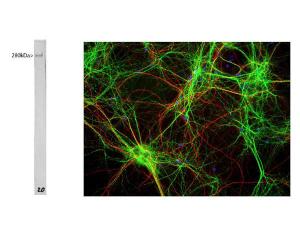 Whole rat brain lysate with mouse anti-MAP2 antibody. The antibody recognizes the ~280 kDa protein. Right: Mixed neuron/glia cultures stained with mouse anti-MAP2 (green) and also rabbit antibody to neurofilament H (Catalog Number BSENR-1388-50) (red).