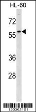 Anti-DCDC2 Rabbit Polyclonal Antibody