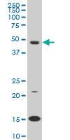 Anti-PBX3 Mouse Monoclonal Antibody [clone: 1A11]