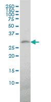 Anti-TREM1 Mouse Monoclonal Antibody [clone: 2E2]