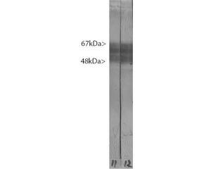 Crude rat brain extract. Tau protein is expressed as up to 9 different isoforms of different molecular weight and so appears as multiple closely spaced bands covering the region of the blot from 48kDa to 67kDa.