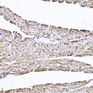 Immunohistochemistry analysis of paraffin-embedded mouse heart using Anti-SAMM50/SAM50 Antibody (A11642) at a dilution of 1:200 (40x lens) Perform high pressure antigen retrieval with 10 mM citrate buffer pH 60 before commencing with IHC staining protocol