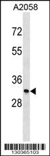 Anti-MGLL Rabbit Polyclonal Antibody