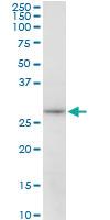 Anti-MAPRE1 Mouse Polyclonal Antibody