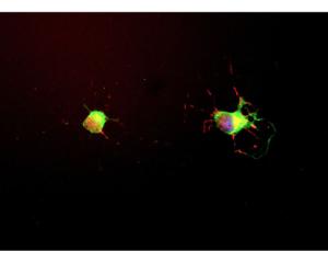 E18 hippocampal neurons were grown for seven days. The neurons were fixed and immunostained with BSENM-1703-100 (red channel). The cells were also stained in green with BSENC-1377-50, our chicken antibody to alpha Internexin and DNA (blue).