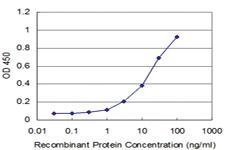 Anti-PBX3 Mouse Monoclonal Antibody [clone: 1A11]