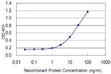 Anti-ZNF100 Mouse Monoclonal Antibody [clone: 3C3]