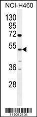 Anti-CPA6 Rabbit Polyclonal Antibody (FITC (Fluorescein Isothiocyanate))