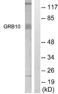 Anti-GRB10 antibody