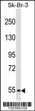 Anti-PCSK4 Rabbit Polyclonal Antibody