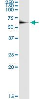 Anti-CPNE1 Polyclonal Antibody Pair