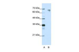 Anti-SF1 Rabbit Polyclonal Antibody