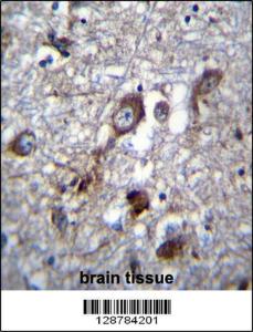 Anti-PLEKHH1 Rabbit Polyclonal Antibody (HRP (Horseradish Peroxidase))