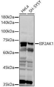 Antibody anti-EIF2AK1 100 µl