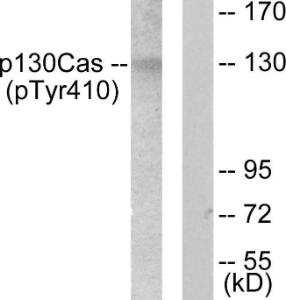 Western blot analysis of lysates from NIH/3T3 cells using Anti-p130 Cas (phospho Tyr410) Antibody. The right hand lane represents a negative control, where the antibody is blocked by the immunising peptide