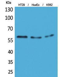 Western blot analysis of HT29, HuvEc, K562 cells using Anti-CYP11B1 + CYP11B2 Antibody