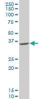 Anti-GDAP1 Mouse Polyclonal Antibody