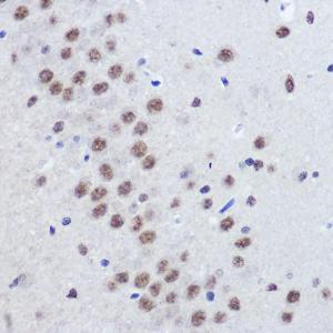 Immunohistochemistry analysis of paraffin-embedded rat brain using Anti-JMJD1C Antibody (A306447) at a dilution of 1:100 (40X lens). Perform microwave antigen retrieval with 10 mM PBS buffer pH 7.2 before commencing with IHC staining protocol