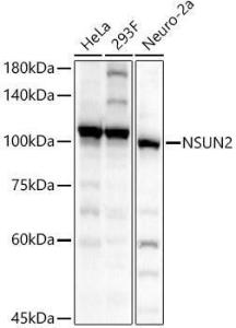 Western blot analysis of various lysates, using Anti-NSUN2/SAKI Antibody (A11647) at 1:1000 dilution. The secondary Antibody was Goat Anti-Rabbit IgG H&L Antibody (HRP) at 1:10000 dilution. Lysates/proteins were present at 25 µg per lane