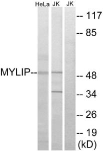 Western blot analysis of lysates from HeLa and Jurkat cells using Anti-MYLIP Antibody. The right hand lane represents a negative control, where the antibody is blocked by the immunising peptide