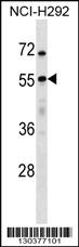 Anti-USP27X Rabbit Polyclonal Antibody