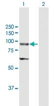 Anti-ELAC2 Rabbit Polyclonal Antibody