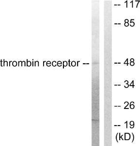 Western blot analysis of lysates from HeLa cells, treated with Nocodazole 1 µg/ml 18h using Anti-Thrombin Receptor Antibody. The right hand lane represents a negative control, where the antibody is blocked by the immunising peptide