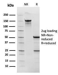 SDS-PAGE analysis of Anti-TOP1MT Antibody [TOP1MT/568] under non-reduced and reduced conditions; showing intact IgG and intact heavy and light chains, respectively. SDS-PAGE analysis confirms the integrity and purity of the antibody