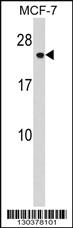 Anti-CHMP1A Rabbit Polyclonal Antibody