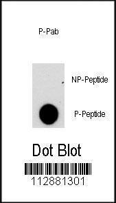 Anti-NFATC2 Rabbit Polyclonal Antibody