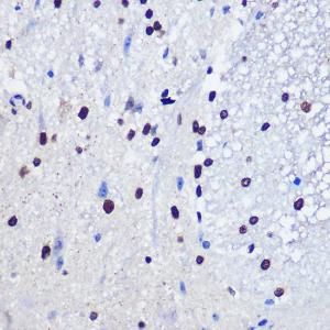 Immunohistochemistry analysis of paraffin-embedded mouse spinal cord using Anti-JMJD1C Antibody (A306447) at a dilution of 1:100 (40X lens). Perform microwave antigen retrieval with 10 mM PBS buffer pH 7.2 before commencing with IHC staining protocol