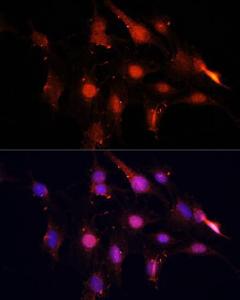 Immunofluorescence analysis of C6 cells using Anti-NSUN2/SAKI Antibody (A11647) at a dilution of 1:100. DAPI was used to stain the cell nuclei (blue)