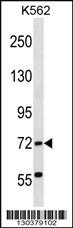 Anti-ABCF2 Rabbit Polyclonal Antibody