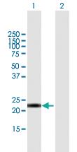 Anti-CALML6 Mouse Polyclonal Antibody