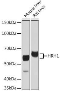 Western blot analysis of extracts of various cell lines, using Anti-HRH1 / H1R Antibody (A306448) at 1:3,000 dilution. The secondary antibody was Goat Anti-Rabbit IgG H&L Antibody (HRP) at 1:10,000 dilution.