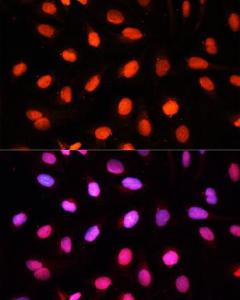 Immunofluorescence analysis of U2OS cells using Anti-NSUN2/SAKI Antibody (A11647) at a dilution of 1:100. DAPI was used to stain the cell nuclei (blue)