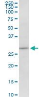 Anti-MAPRE1 Mouse Polyclonal Antibody