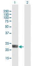 Anti-BORCS5 Mouse Polyclonal Antibody