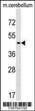 Anti-CHST2 Rabbit Polyclonal Antibody (HRP (Horseradish Peroxidase))