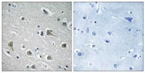 Immunohistochemical analysis of paraffin-embedded human brain tissue using Anti-MYLIP Antibody. The right hand panel represents a negative control, where the antibody was pre-incubated with the immunising peptide