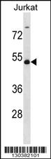 Anti-WTAP Rabbit Polyclonal Antibody