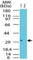 Anti-RAX Rabbit Polyclonal Antibody