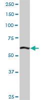 Anti-ELAC2 Rabbit Polyclonal Antibody