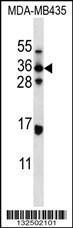 Anti-ELOVL5 Rabbit Polyclonal Antibody (FITC (Fluorescein Isothiocyanate))