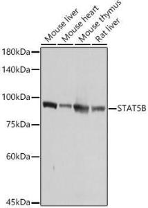 Anti-STAT5 antibody