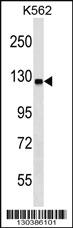 Anti-UBA6 Rabbit Polyclonal Antibody